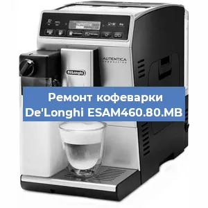 Ремонт заварочного блока на кофемашине De'Longhi ESAM460.80.MB в Краснодаре